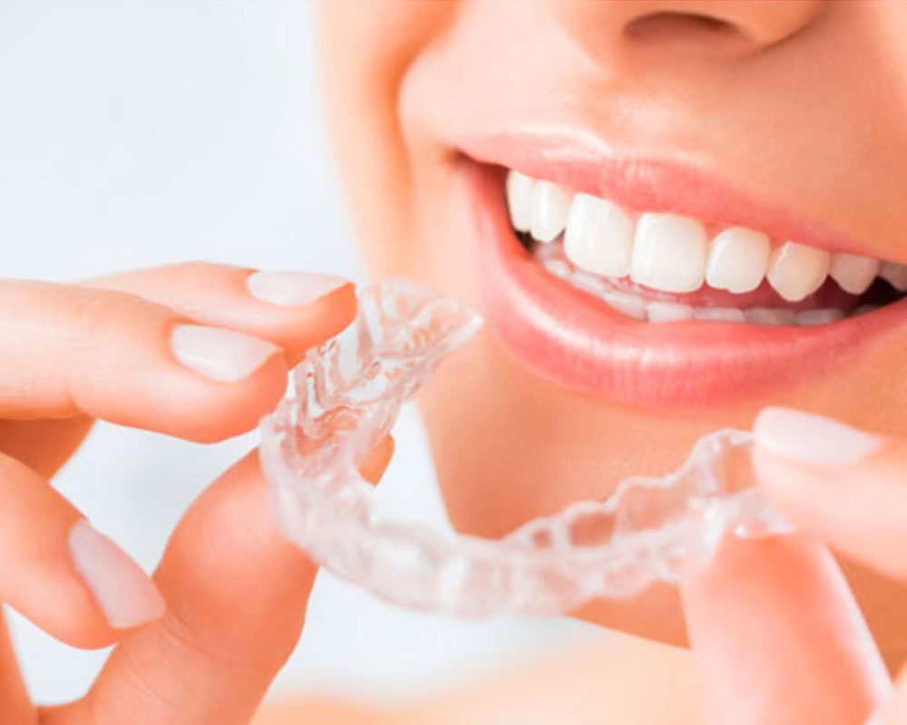 จัดฟันใส แบบ Invisalign