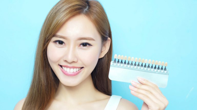 คอมโพสิตวีเนียร์