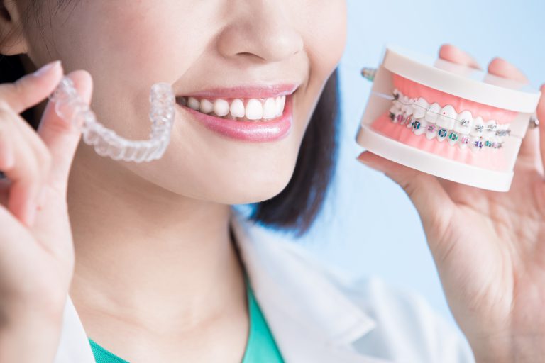 จัดฟัน Invisalign