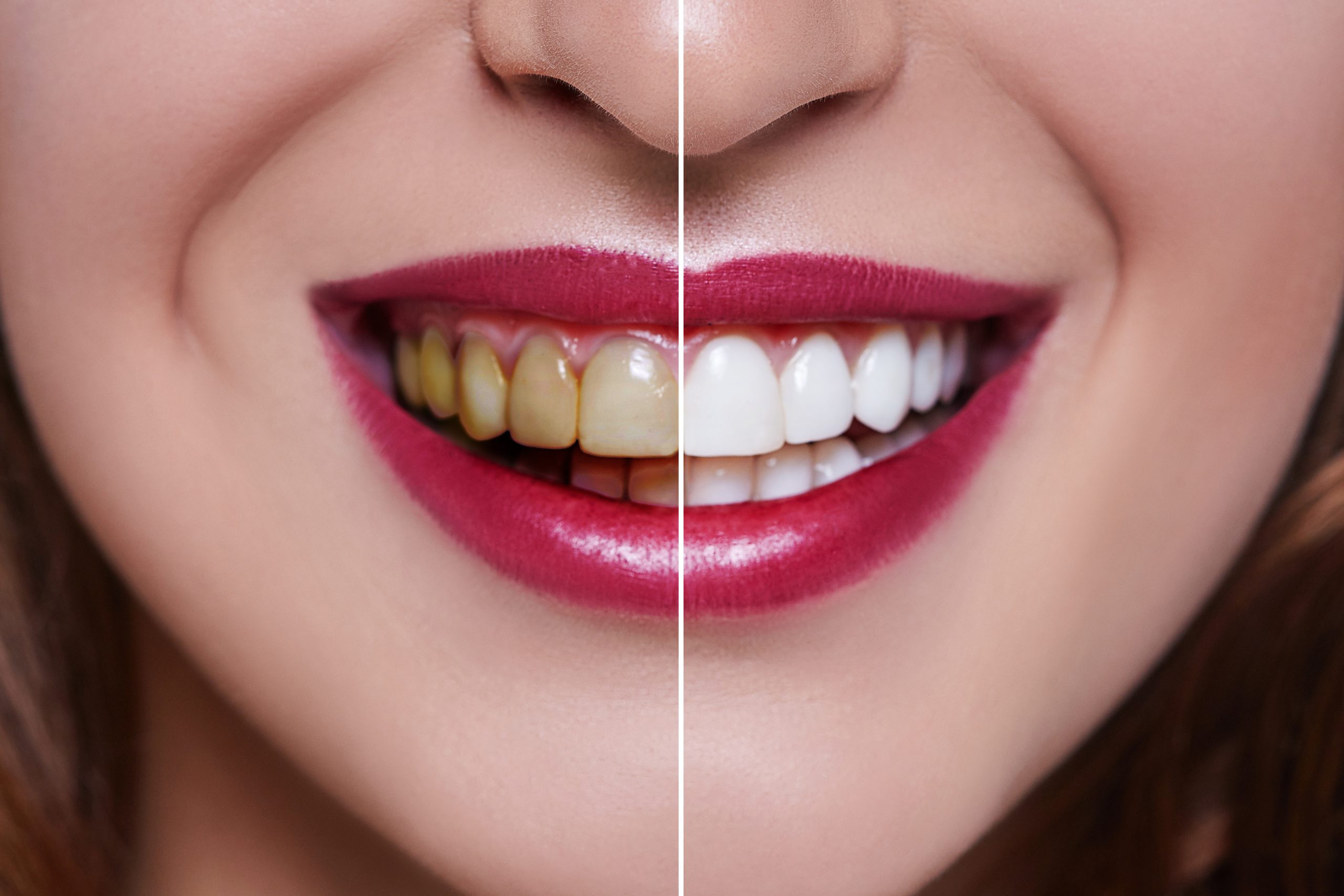  Dental