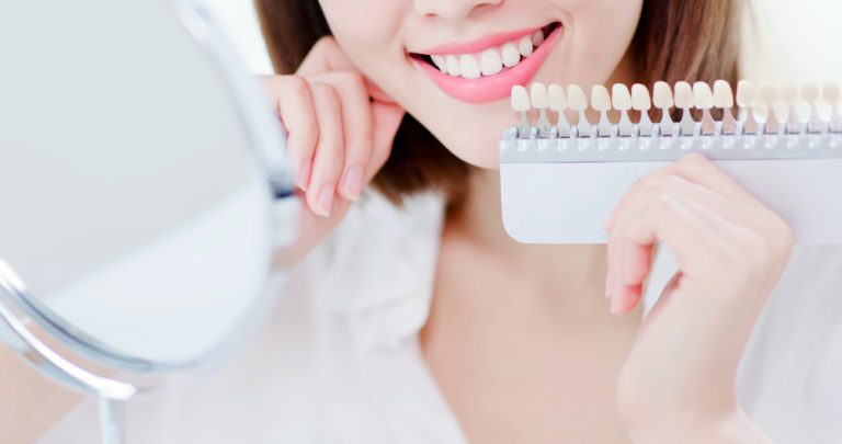 ดูแลฟันหลังการฟอกสีฟันขาวนานทำอย่างไร Dental Life มีคำตอบ