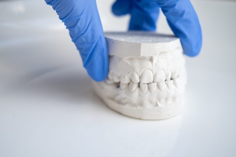 ฟันสบผิดปกติ สำคัญอย่างไรกับสุขภาพช่องปาก?