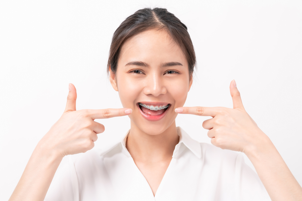 จัดฟันรอบสองต่างจากรอบแรกอย่างไร? ต้องเตรียมตัวอย่างไร? Dental Life หาคำตอบมาให้แล้ว
